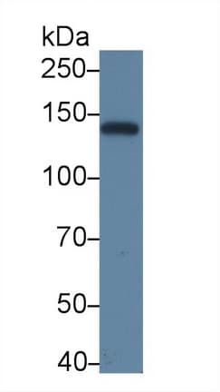 ABCB4 / MDR3 Antibody