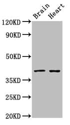 Polyclonal Rabbit anti-Human LASS1 Antibody (IHC, WB)