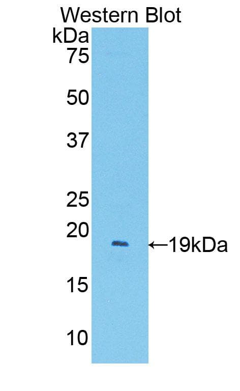 PECAM-1 / CD31 Antibody (aa78-214, Biotin)