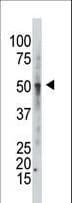 GCNT1 / C2GNT Antibody (aa399-428)