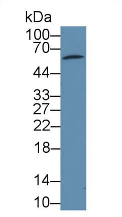 PDP2 Antibody (PE)