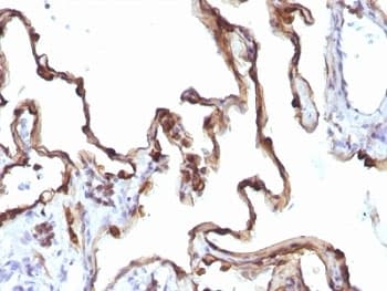 KRT7 / CK7 / Cytokeratin 7 Antibody (clone KRT7/1198)