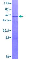 Human FBXL18 Protein (Recombinant GST)