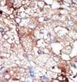 GAK Antibody (aa1140-1170)