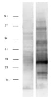 ZBED3 Protein (Over-Expression Lysate Myc-DDK (Flag))