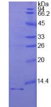 Human IL1R1 Protein (Recombinant His, N-Terminal)