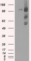 BUB1B / BubR1 Antibody (clone OTI11G2)