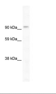 PIK3CB / PI3K Beta Antibody (C-Terminus)