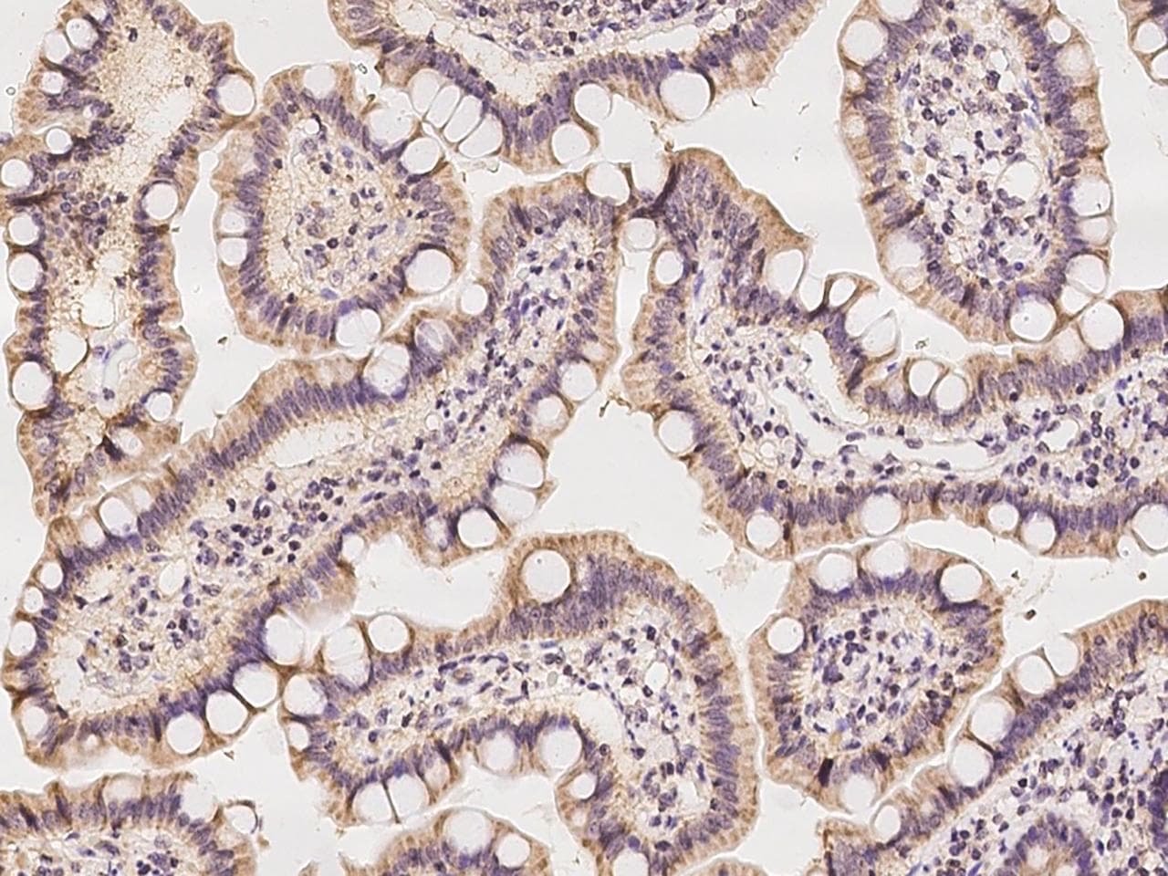 Polyclonal Rabbit anti-Human IDH3G Antibody (IHC)