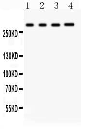 Polyclonal Rabbit anti-Human ITPR1 / IP3 Receptor Type 1 Antibody (aa2411-2758, IHC, WB)