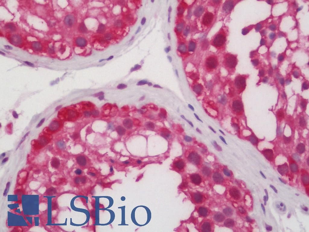 IHC-plus™ Polyclonal Rabbit anti-Human PRKCZ / PKC-Zeta Antibody (aa376-425, IHC, IF, WB)