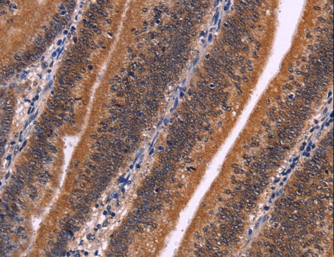 CDC5 / CDC5L Antibody