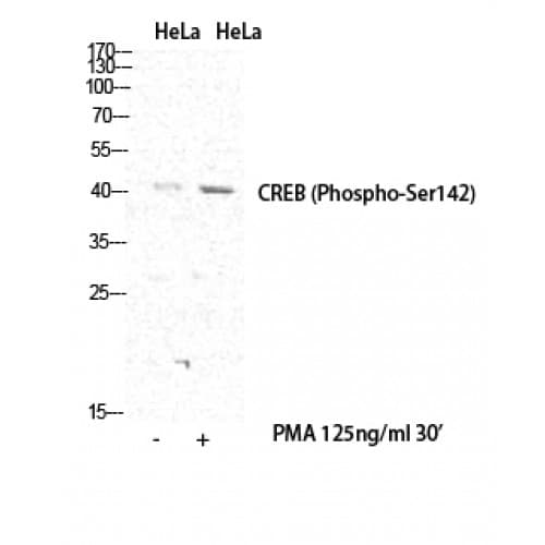 CREB1 / CREB Antibody (80-160 aa)