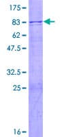 Human FBXO38 Protein (Recombinant GST)