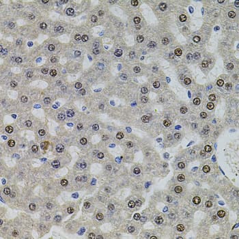 SR140 / U2SURP Antibody