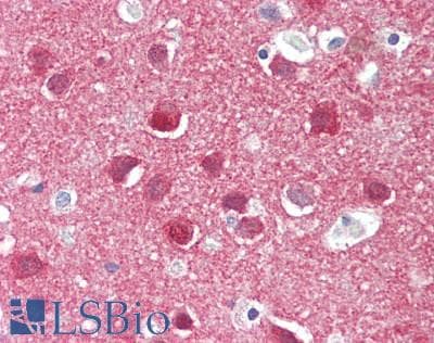 IHC-plus™ Polyclonal Rabbit anti-Human CXCR4 Antibody (IHC, WB)