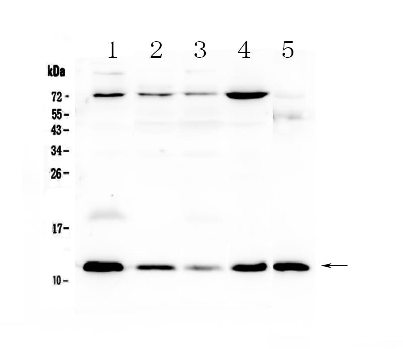 Polyclonal Rabbit anti-Human DYNLT1 / TCTEX-1 Antibody (IHC, WB)