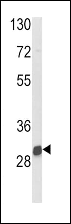 NAT2 Antibody (aa226-254)