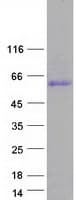 Human CCDC85C Protein (Recombinant Myc-DDK (Flag))