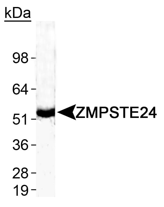 ZMPSTE24 Antibody (aa400-475)