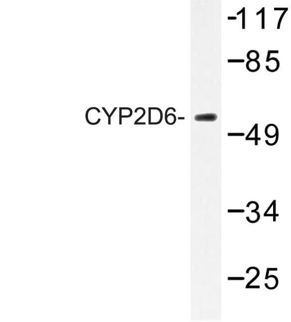 Polyclonal Rabbit anti-Human CYP2D6 Antibody (Ala277, IHC, WB)