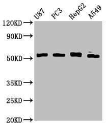Polyclonal Rabbit anti-Human PPP2R2D Antibody (IHC, IF, WB)