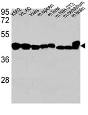 IHC-plus™ ACTB / Beta Actin Antibody (clone 137CT26.1.1)