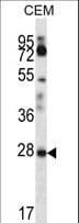 RARRES1 Antibody (aa134-163)