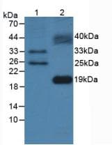 FLT3LG / Flt3 Ligand Antibody (PE)