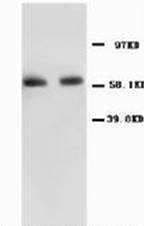 RELA / NFKB p65 Antibody (N-Terminus)