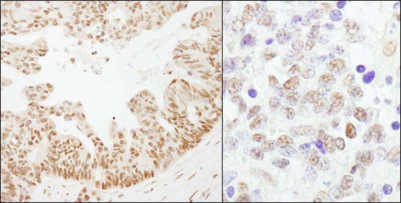 Polyclonal Rabbit anti-Human CSTF2 / CstF-64 Antibody (aa527-577, IHC, WB)