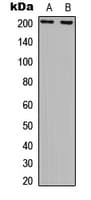 ERCC5 / XPG Antibody (N-Terminus)