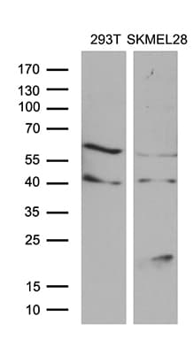 MLANA / Melan-A Antibody (aa48-118, clone OTI6G3)