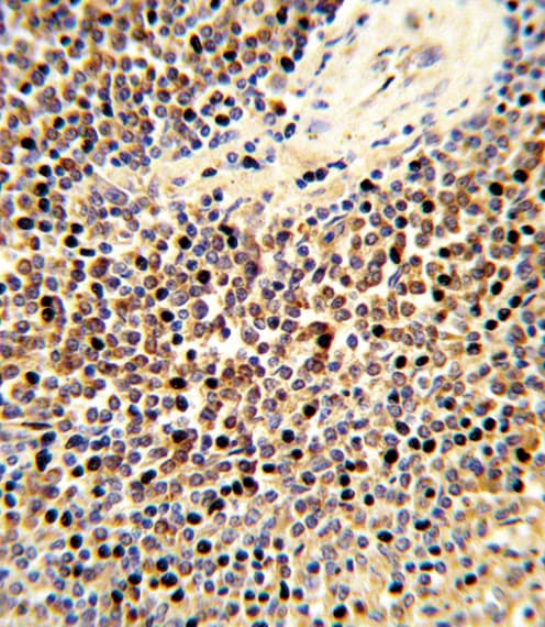 CYP24 / CYP24A1 Antibody (aa466-494)
