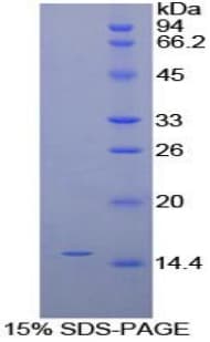 Human GLA / Alpha Galactosidase Protein (Recombinant His-S)