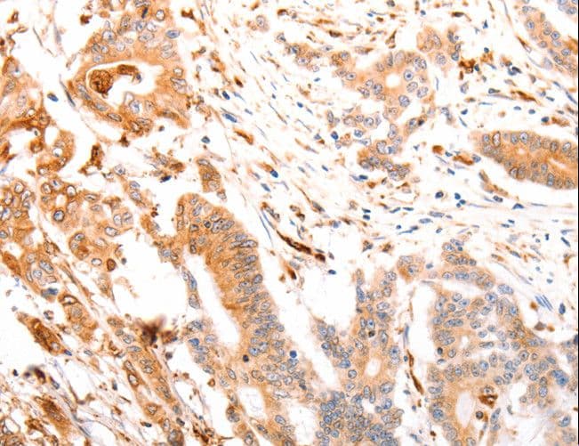 ABCA4 Antibody