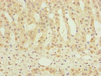 NDUFS6 Antibody