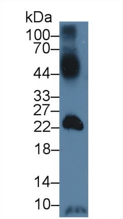 SLC2A14 Antibody (aa1-105, PE)