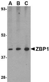 IHC-plus™ Polyclonal Rabbit anti-Human ZBP1 Antibody (IHC, IF, WB)