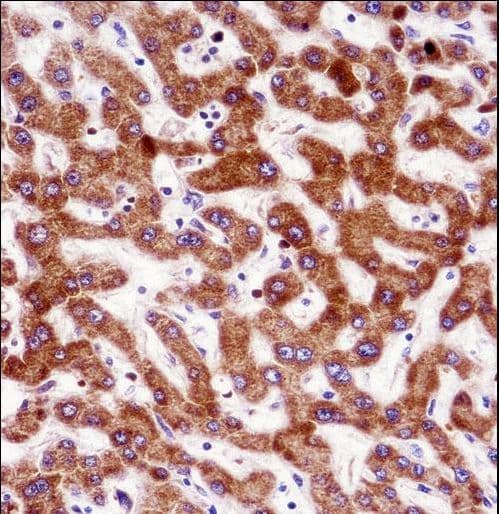 IHH Antibody (aa51-80)