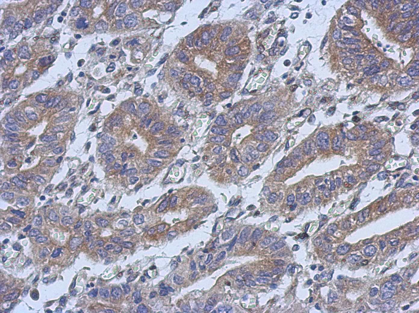 Polyclonal Rabbit anti-Human HAUS4 Antibody (IHC, WB)