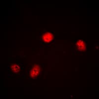 JUNB / JUN-B Antibody (C-Terminus)