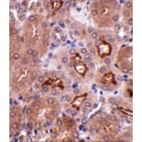 Polyclonal Rabbit anti-Human OTUD5 Antibody (IHC, IF, WB)