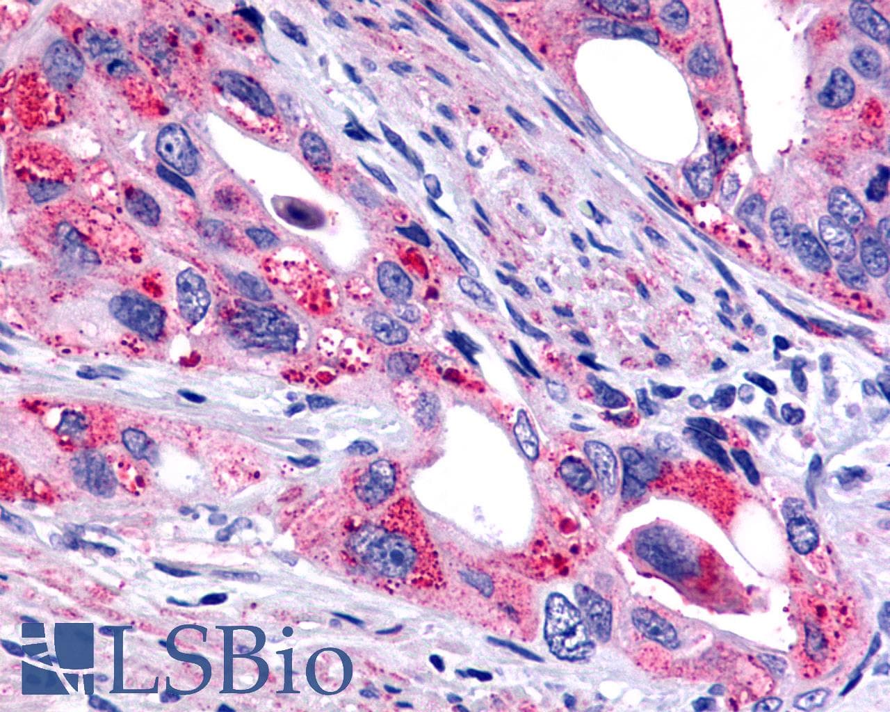 PathPlus™ GALR2 / Galanin Receptor 2 Antibody (C-Terminus)