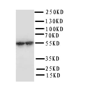 P450SCC / CYP11A1 Antibody (aa507-521)