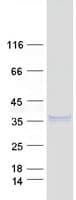 Human NGF Protein (Recombinant Myc-DDK (Flag))