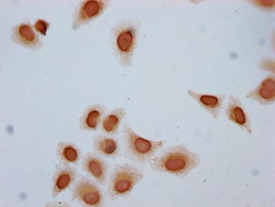 HIST1H2BN Antibody