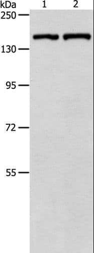 PTCH1 / Patched 1 Antibody
