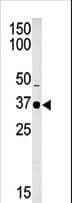 SETD7 / SET7 Antibody (aa289-317)