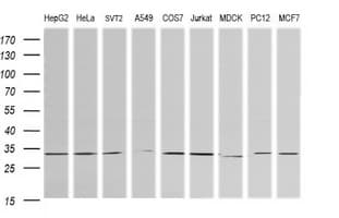RARRES1 Antibody (clone OTI1B3)
